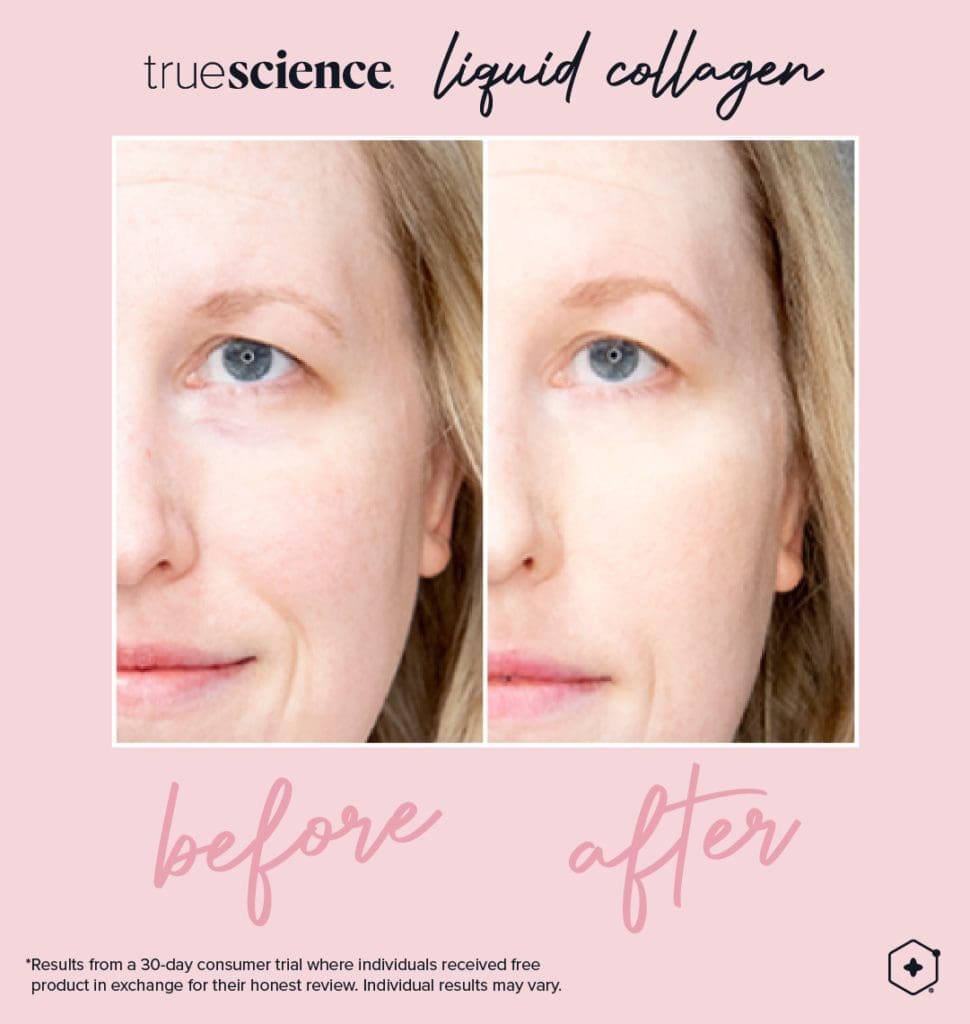 Revitalisieren Sie Ihre Haut mit dem besten Kollagenzusatz: Lifevantage Flüssiges Kollagen 5 Kollagen Sichtbare Vorteile Vermögenswerte_Unsichtbare Ergebnisse-11
