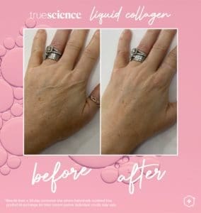 Benefici visibili del collagene Attività_Risultati visibili-12