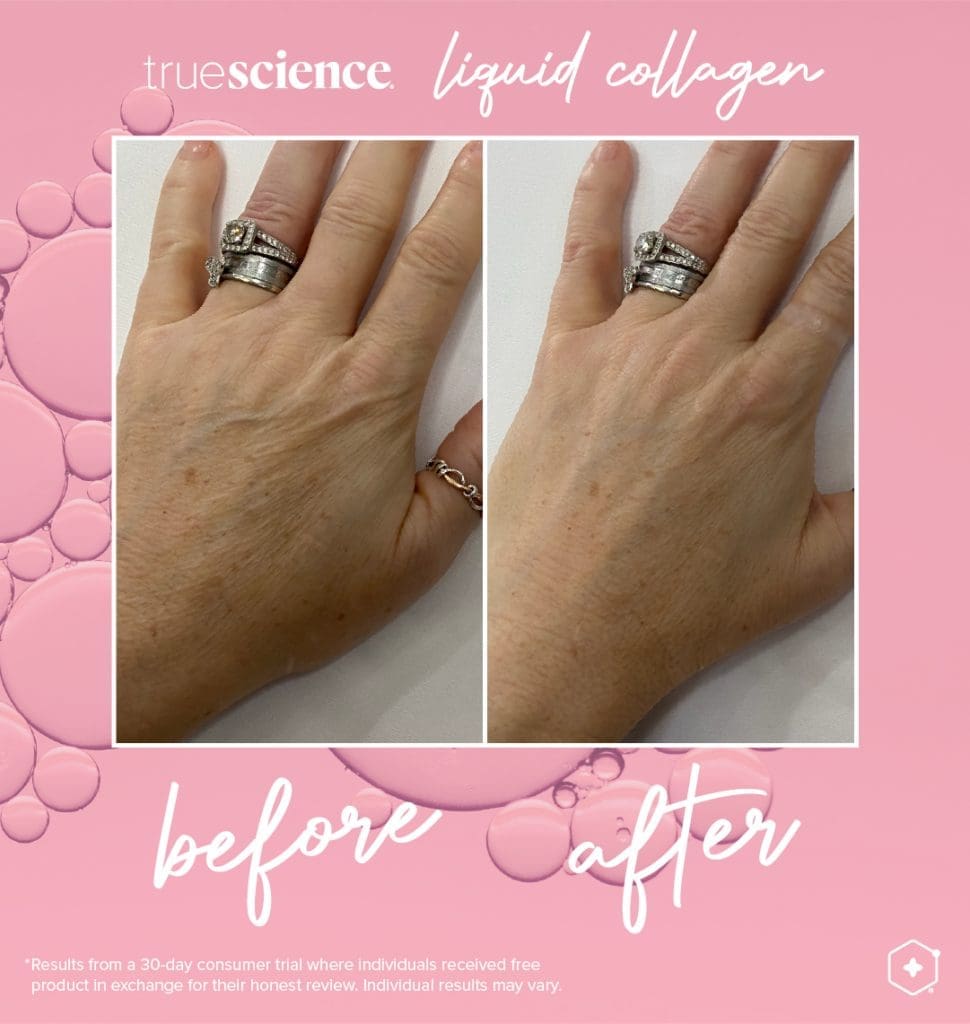Revitalisieren Sie Ihre Haut mit dem besten Kollagenzusatz: Lifevantage Flüssiges Kollagen 6 Kollagen Sichtbare Vorteile Vermögenswerte_Unsichtbare Ergebnisse-12