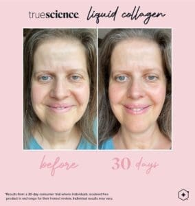 Collagene Benefici visibili Attività_Risultati visibili-14