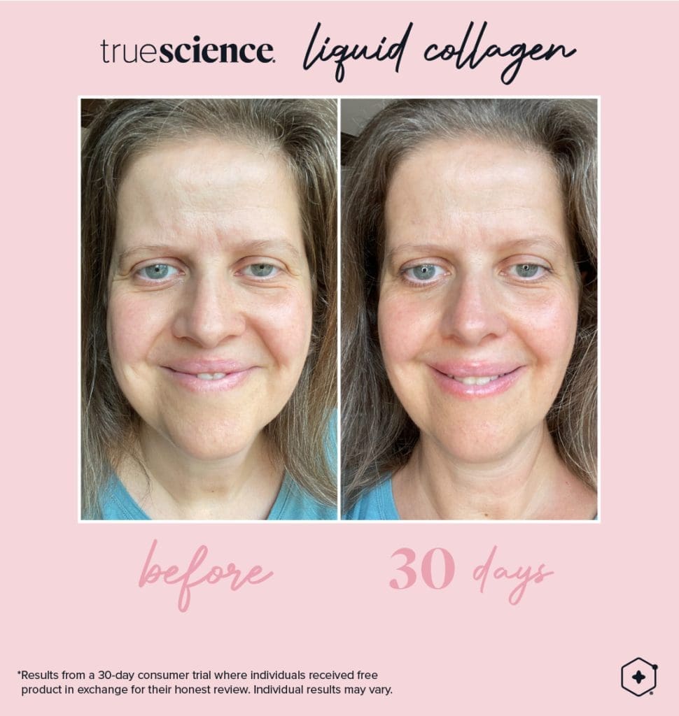 Revitalisieren Sie Ihre Haut mit dem besten Kollagenzusatz: Lifevantage Flüssiges Kollagen 7 Kollagen Sichtbare Vorteile Vermögenswerte_Unsichtbare Ergebnisse-14