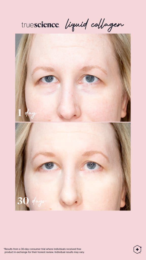 Revitalisieren Sie Ihre Haut mit dem besten Kollagenzusatz: Lifevantage Flüssiges Kollagen 9 Kollagen Sichtbare Vorteile Vermögenswerte_Unsichtbare Ergebnisse-15