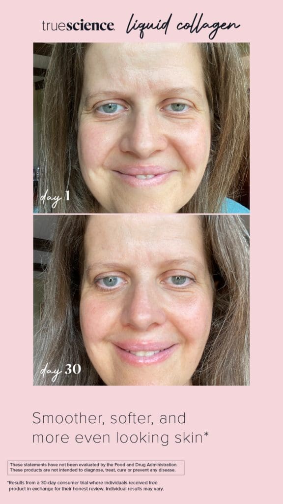 Revitalisieren Sie Ihre Haut mit dem besten Kollagenzusatz: Lifevantage Flüssiges Kollagen 10 Kollagen Sichtbare Vorteile Vermögenswerte_Unsichtbare Ergebnisse-17