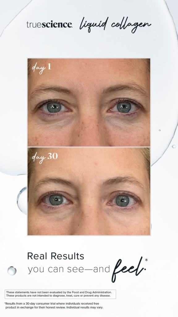 Revitalisieren Sie Ihre Haut mit dem besten Kollagenzusatz: Lifevantage Flüssiges Kollagen 11 Kollagen Sichtbare Vorteile Vermögenswerte_Unsichtbare Ergebnisse-18