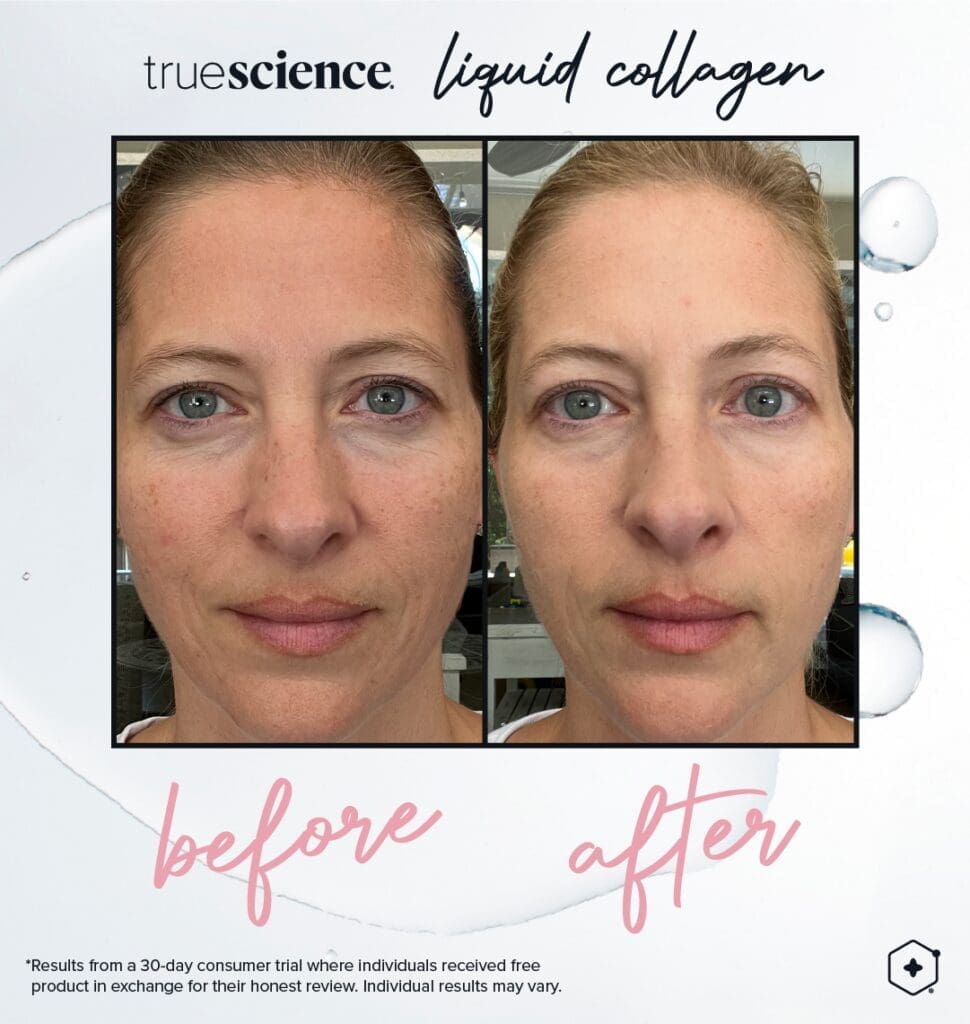 Revitalisieren Sie Ihre Haut mit dem besten Kollagenzusatz: Lifevantage Flüssiges Kollagen 4 Collagen Sichtbare Vorteile Vermögenswerte_Unsichtbare Ergebnisse-20