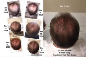 Transforme su rutina capilar con los cuidados Truescience 10 Resultados del sistema LifeVantage Hair Care 2