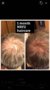 Transforme su rutina con el cuidado capilar Truescience para obtener resultados asombrosos 6 Resultados del sistema LifeVantage Hair Care 0
