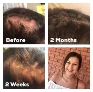 Transforme su rutina con el cuidado capilar Truescience para obtener resultados sorprendentes 9 Resultados del sistema LifeVantage Hair Care 1