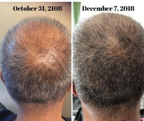 Transforme su rutina con el cuidado capilar Truescience para obtener resultados sorprendentes 12 Resultados del sistema LifeVantage Hair Care 4