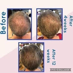Transforme su rutina con el cuidado capilar Truescience para obtener resultados sorprendentes 8 Resultados del sistema LifeVantage Hair Care 6