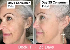 Testimonianza sui risultati del collagene liquido