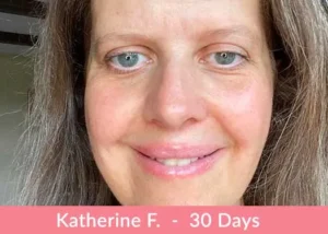 Testimonianza sui risultati del collagene liquido