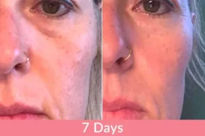 Testimonianza sui risultati del collagene liquido