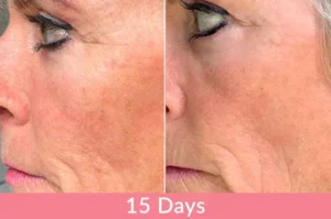 Testimonianza sui risultati del collagene liquido