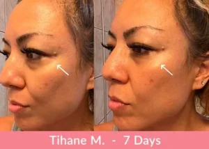 Testimonianza sui risultati del collagene liquido