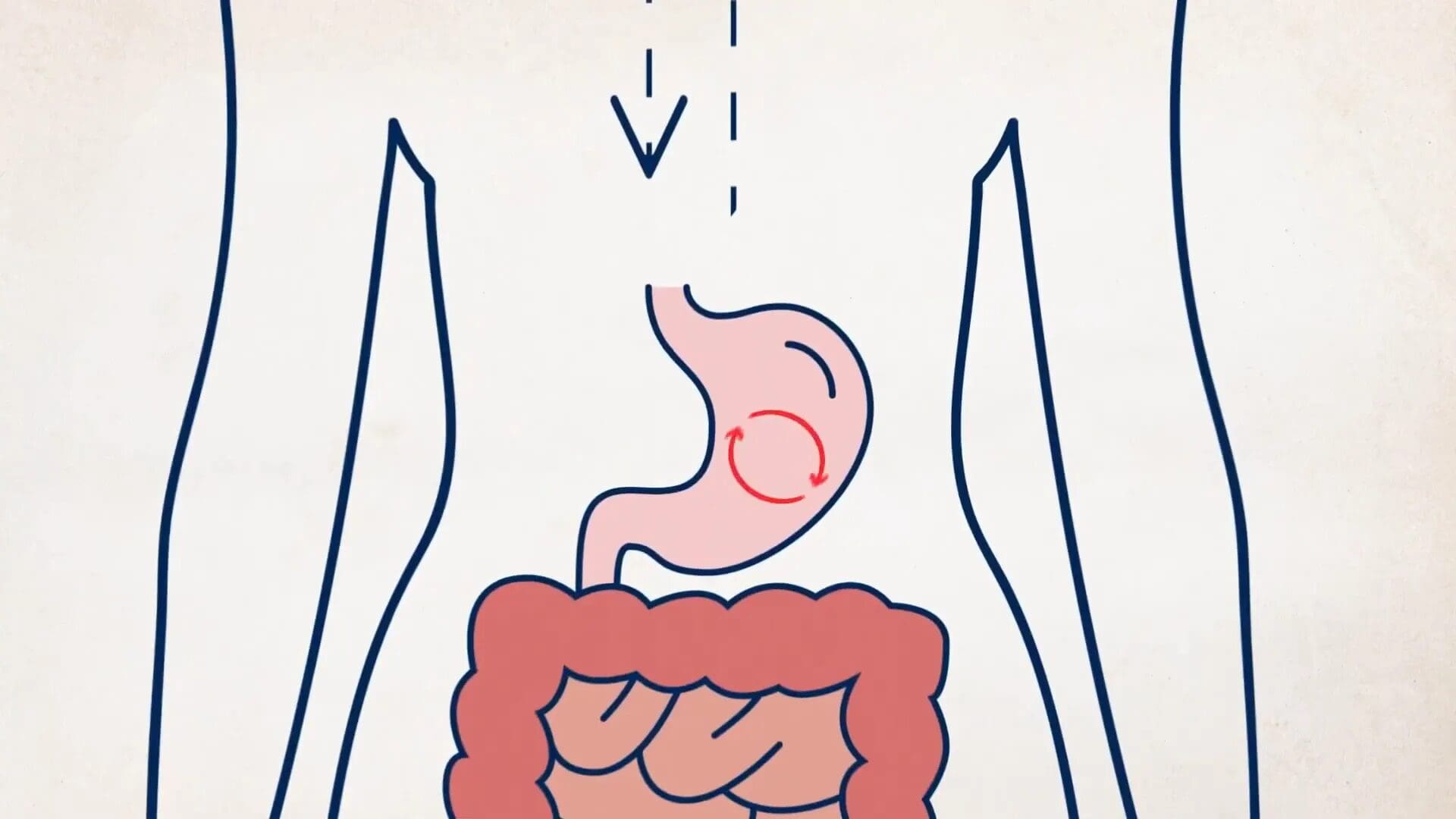 MindBody GLP-1-systeem