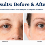 Résultats de la collection de soins activés TrueScience