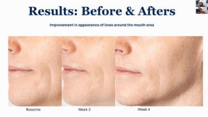 Risultati della collezione TrueScience Activated Skin Care